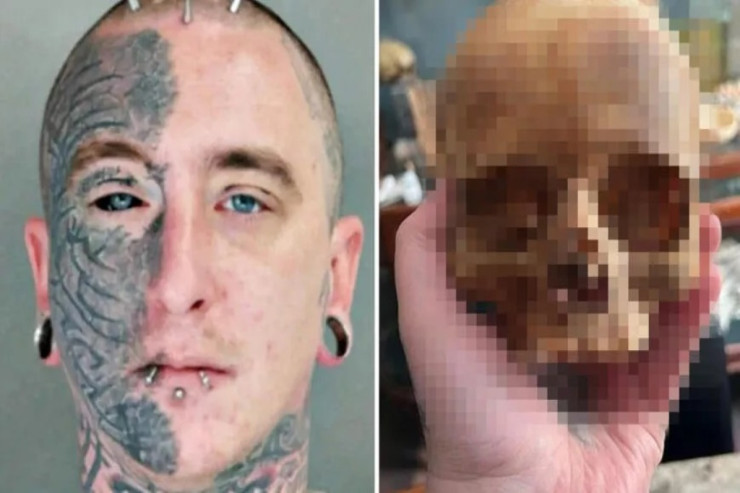 "Morq" işçisindən QALMAQAL:  Sosial şəbəkədə ölənlərin orqanlarını satdı