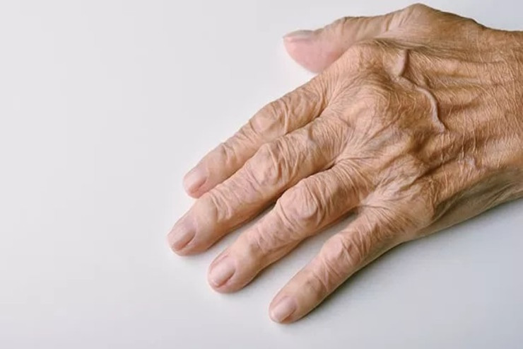 Əllərimizin yaşlı görünməməsi   üçün nə etməliyik?