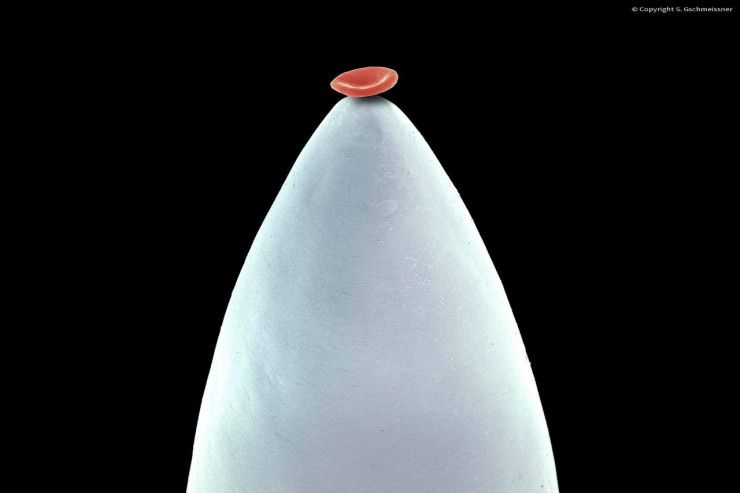 İynənin ucunda qan damlası belə görünür – MİKROSKOP ALTINDA  