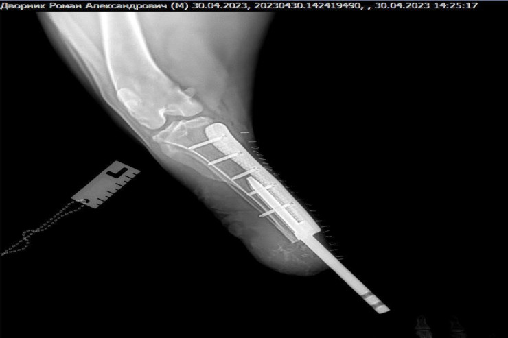 İtə biointeqrasiyalı protez qoyuldu-FOTO -VİDEO 