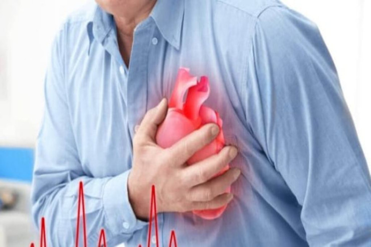 Süni intellekt  infarktı   99 faiz dəqiqliklə diaqnoz edir