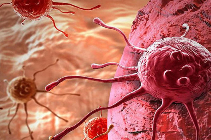 Bu əlamətlər ilkin xərçəngdən XƏBƏR VERİR 