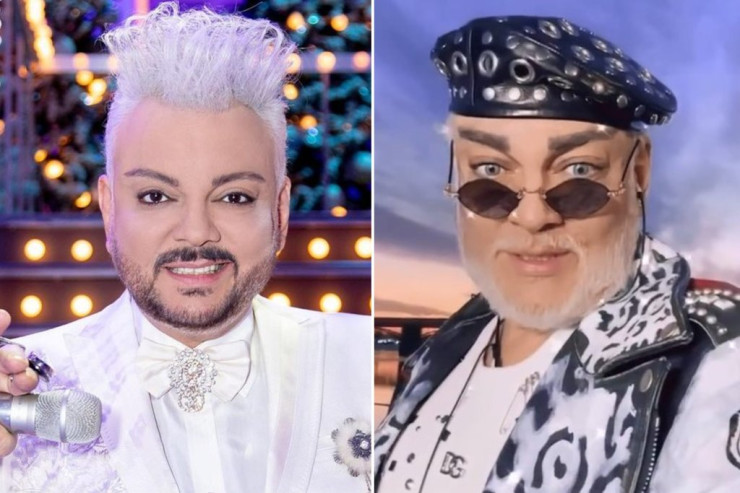 Filipp Kirkorov yenidən əməliyyat  etdirir –  “Sensasiya olacaq” 