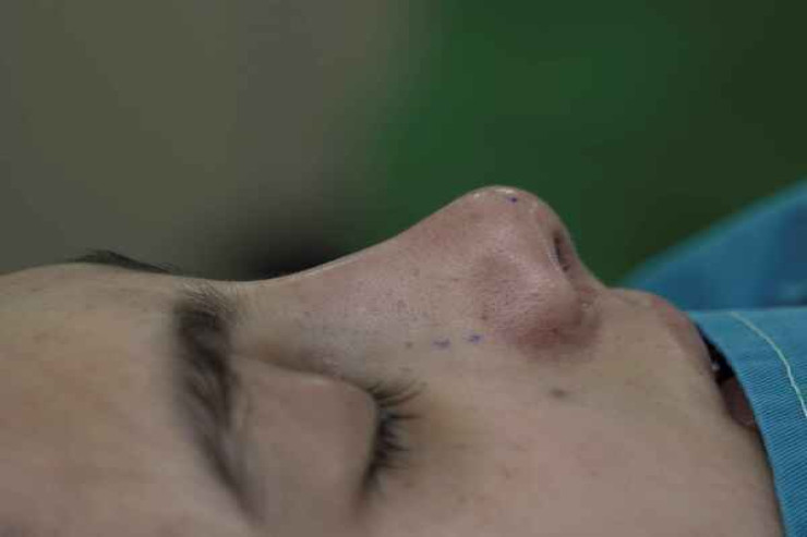 Məşhur müğənni  səkkizinci dəfə   əməliyyat olundu