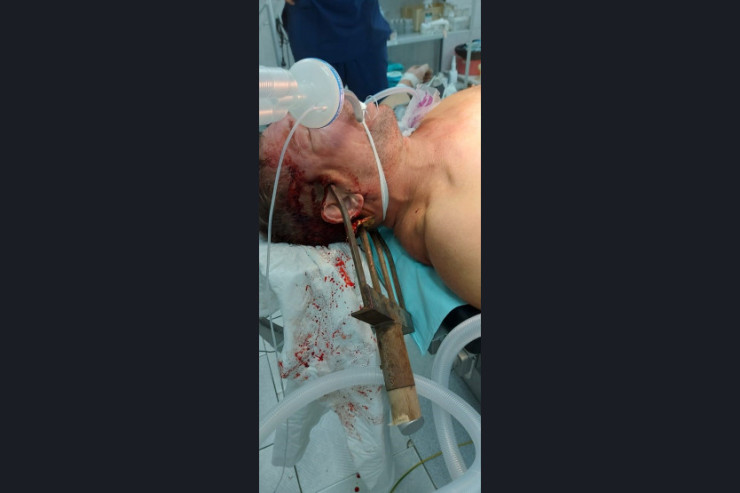 53 yaşlı kişi yabanı BAŞINA SANCDI 