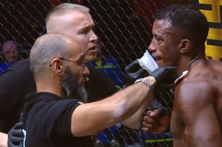 MMA döyüşçüsü rəqibin qulağını qopardı 