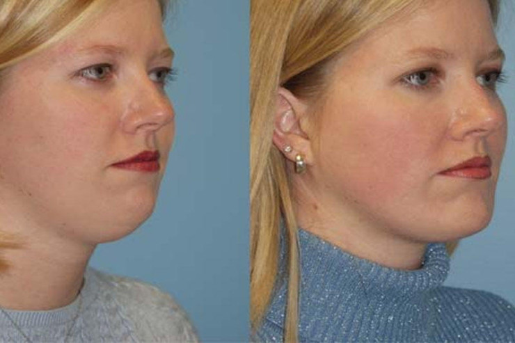 Buxağın yaranmasının əsas SƏBƏBLƏRİ 