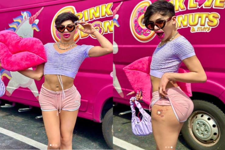 Oğlan özünü kuklaya çevirmək üçün 100 min dollar xərclədi  