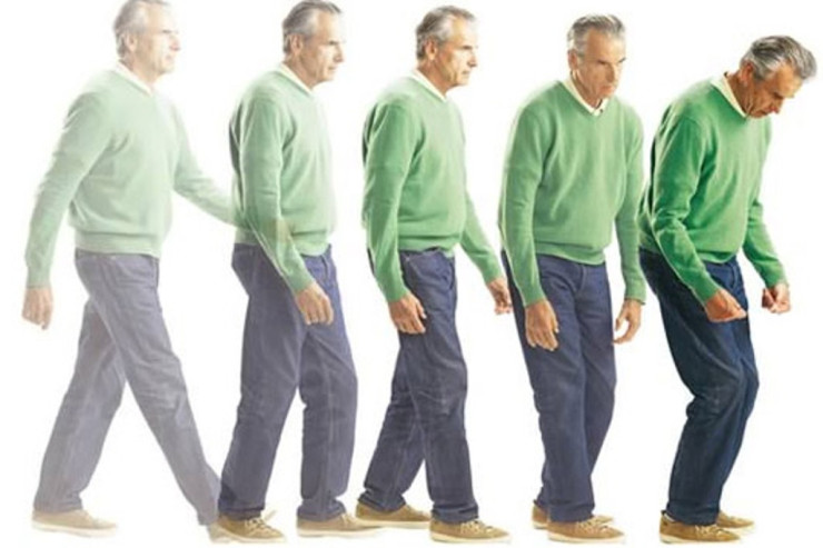 “Parkinson” xəstəliyi beyində yox, bağırsaqda yaranırmış 