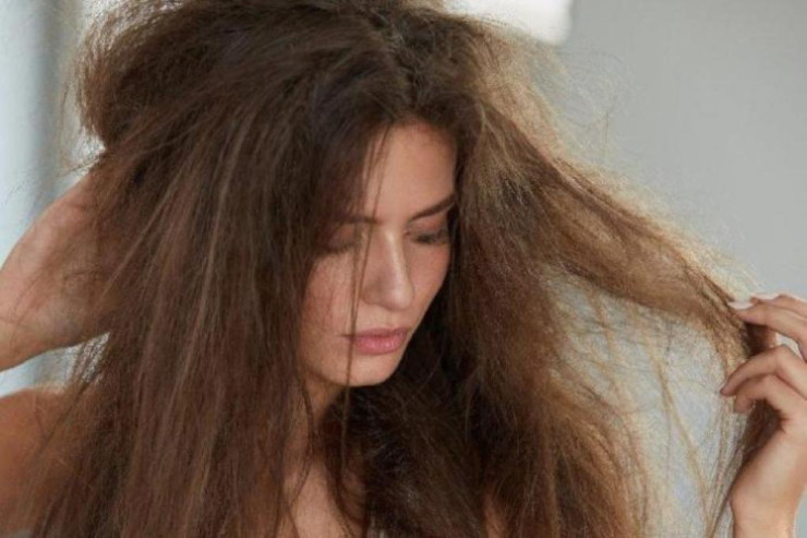 Saçları korlayan 6 pis VƏRDİŞ 