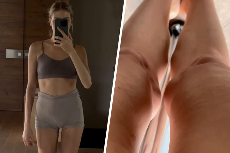 Milyarderin arvadı ayaqlarındakı selüliti paylaşdı