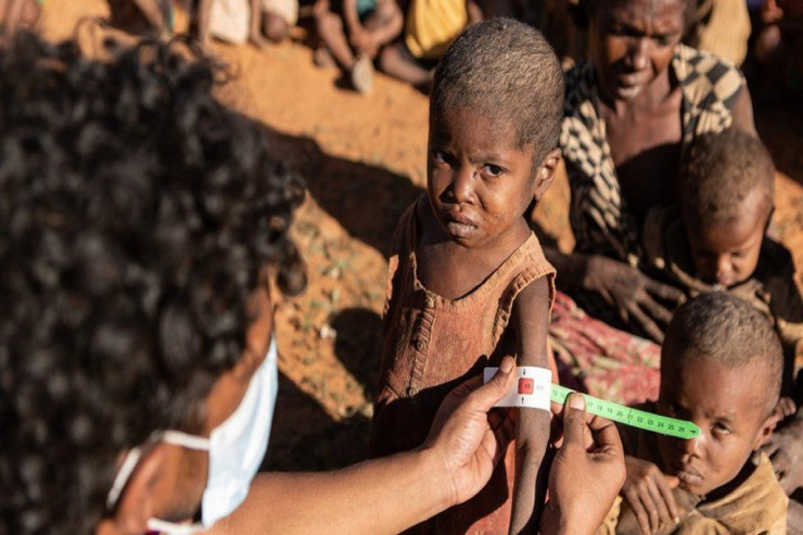 Dünyadakı ac insanları sayı  rekord həddə   çatdı