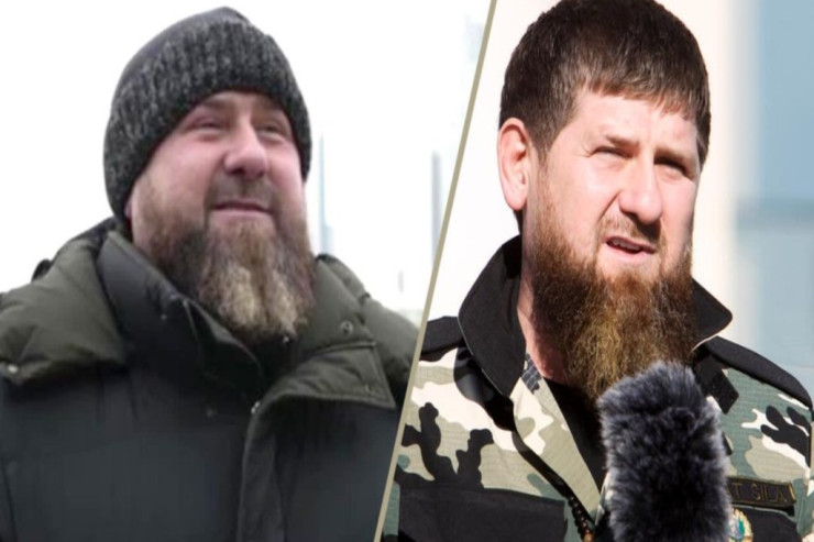 Kadırov  beyin ölümü   keçirib: Moskvaya xaricdən həkimlər çağırılıb - MƏNBƏ