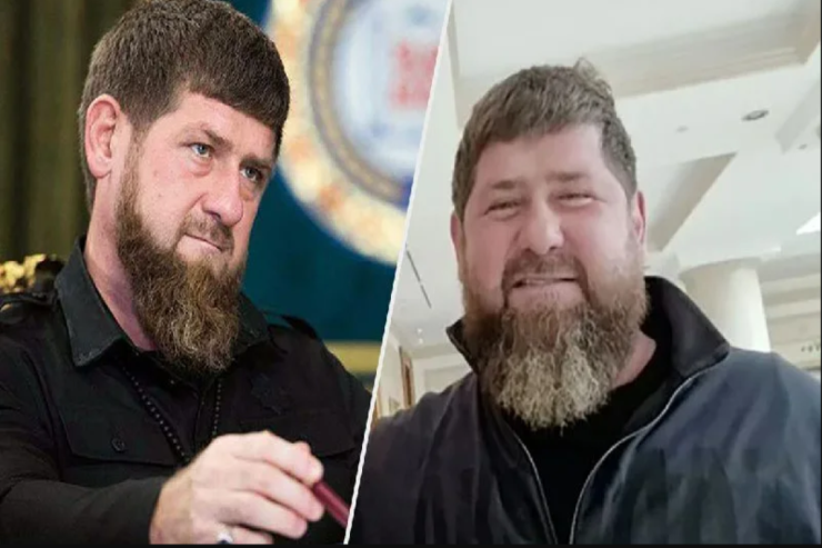 Ramzan Kadırovun  vəziyyəti ilə bağlı   SON XƏBƏR