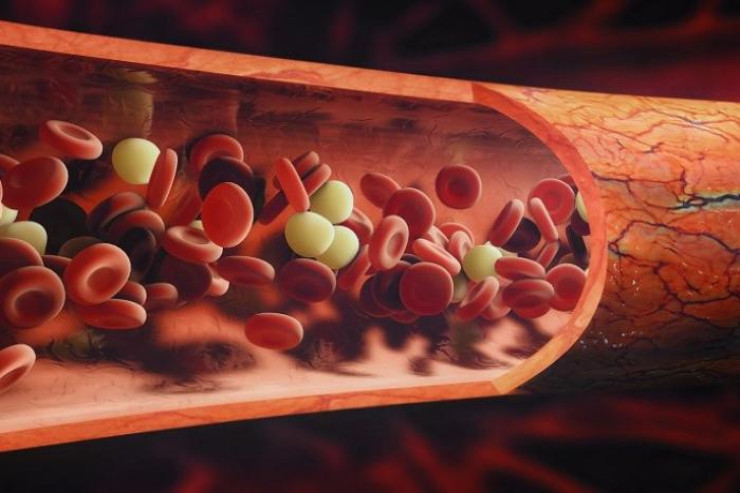 Qandakı hemoqlobini necə tez artırmaq olar? 