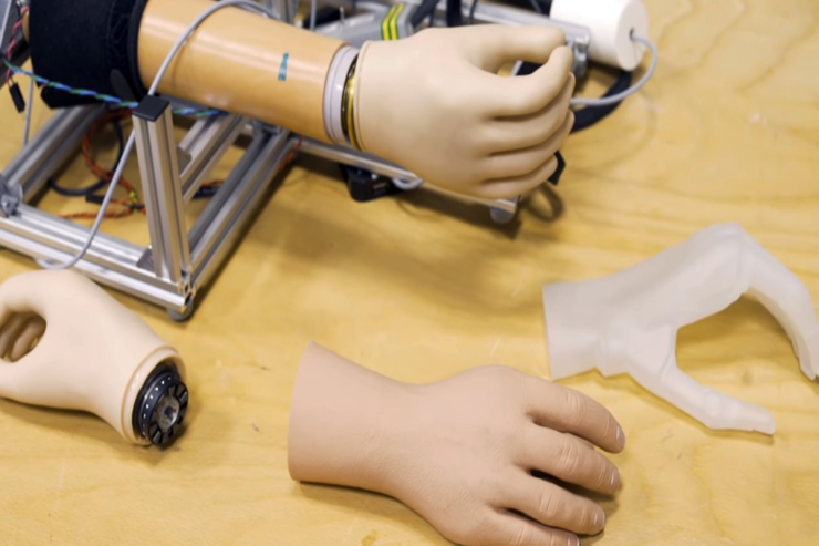 100 il əvvəl qol proztezi belə işləyirdi-VİDEO 