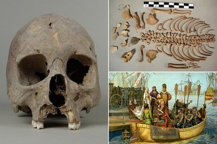 Sifilisi Avropada Kristofer Kolumb  yaymayıb   - ARAŞDIRMA