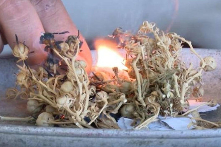 Üzərlik  yandıranda   nə demək lazımdır?