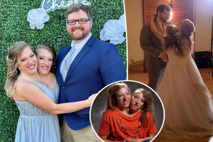 Siam əkizlərinin ikincisi də  evlənməyə   hazırlaşır