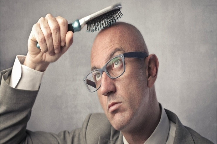 Niyə qadınlara nisbətən kişilərdə  keçəlləşmə   daha çox yayılıb? - MARAQLI FAKT 