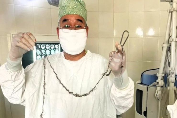 8 yaşlı qızın beynindən bir metr tük çıxarıldı 