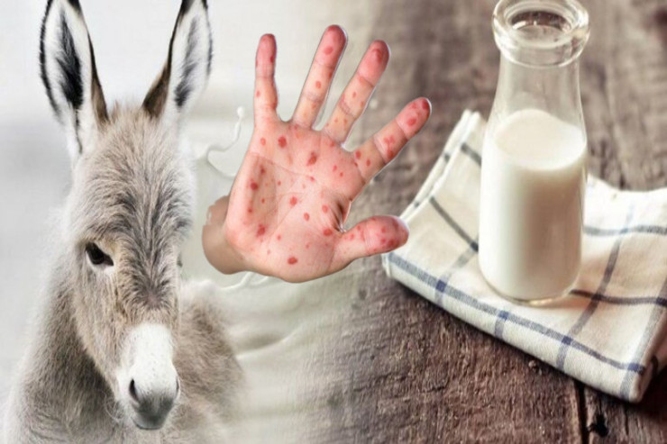 Tüğyan edən qızılcanı bıçaq kimi “kəsən”  dərman – 100 manat xərci var 