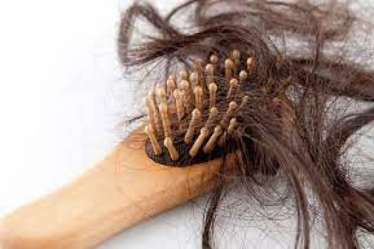 Gözləmədəyiniz diabet simptomu:  Saç tökülməsi