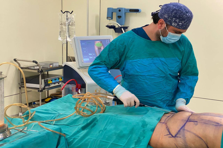 Məşhur müğənnidən plastik əməliyyatla bağlı iddialara CAVAB 