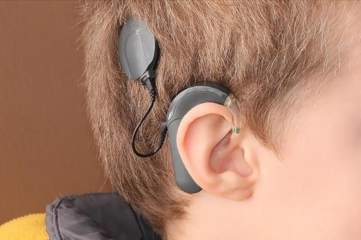 Cihazlardan istifadə eşitmə qüsurlu insanların ömrünü uzada bilər