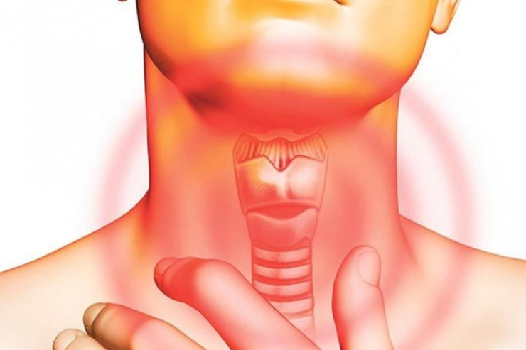 Qırtlaq xərçənginin daha bir ƏLAMƏTİ 