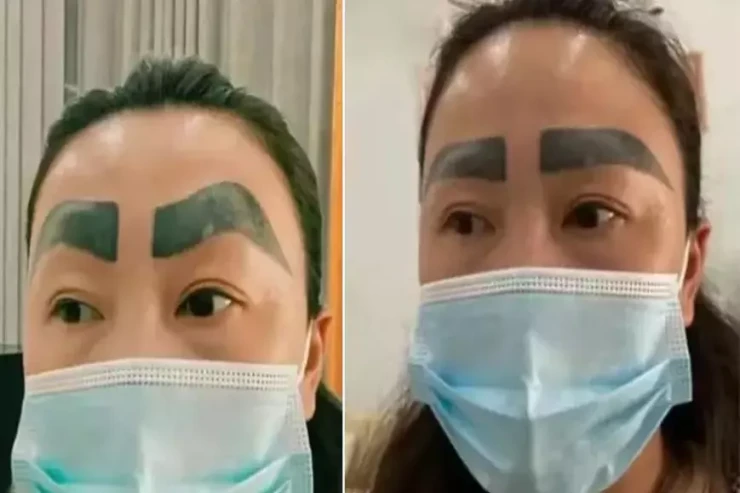 Estetik fəlakəti!  - Qaş düzəldəcəyi yerdə, göz çıxardı