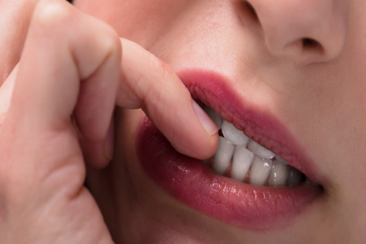 Dırnaqlarınızı yeməyi  dayandırmaq üçün   5 MƏSLƏHƏT