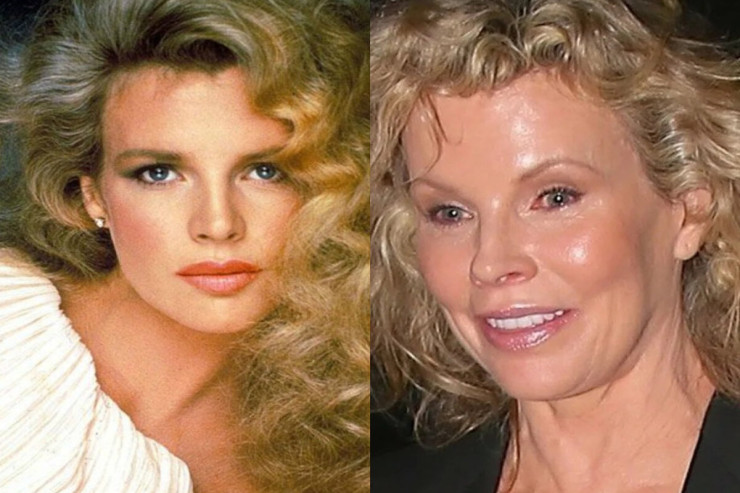 Dünya kinosunun ən gözəl qadınları ƏVVƏL VƏ İNDİ 