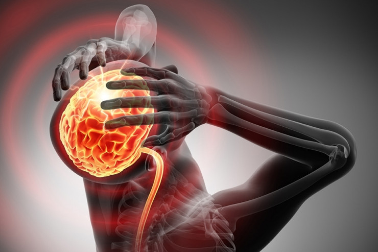 Baş ağrısının SƏBƏBLƏRİ 