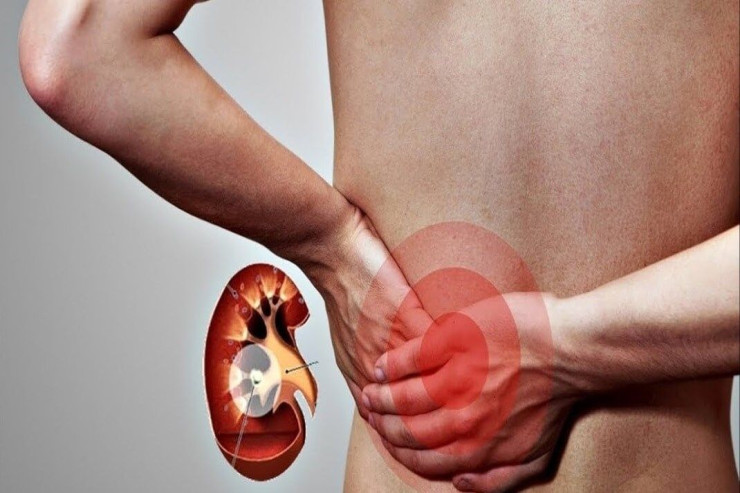 Böyrək xəstəliklərinin az bilinən  ƏLAMƏTLƏRİ