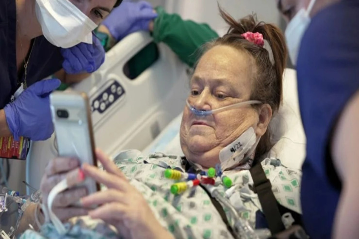 Donuz böyrəyi transplantasiya olunmuşdu - Vəfat etdi 