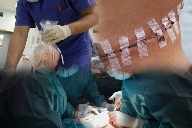 Azərbaycanda orqan alverinin “QARA BAZAR”I  - QİYMƏTLƏR 