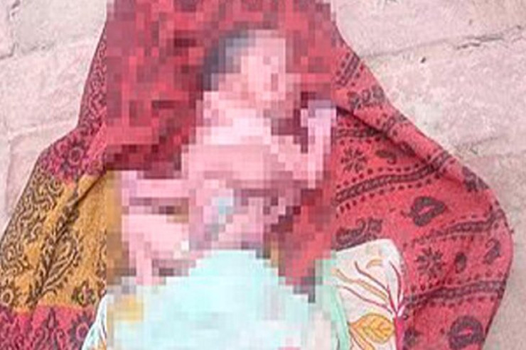 Dörd ayaqlı və dörd qollu körpə doğuldu 