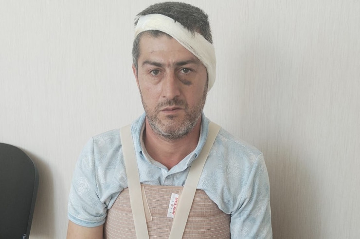 Bərdə sakininin qulağını kəsiblər?  - Polis araşdırır