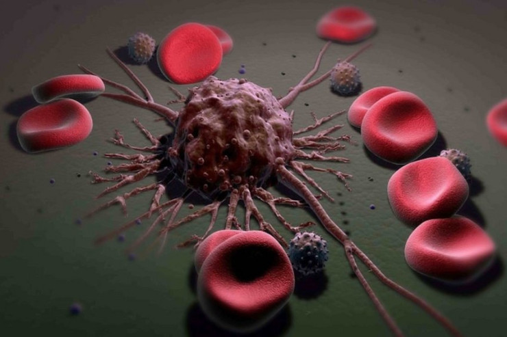 Bu yağ qidaların çoxunda var,  xərçəng metastazına   SƏBƏB OLUR