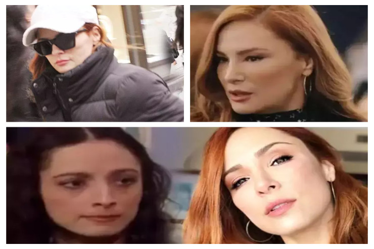 Məşhur aktrisa  tanınmaz halda