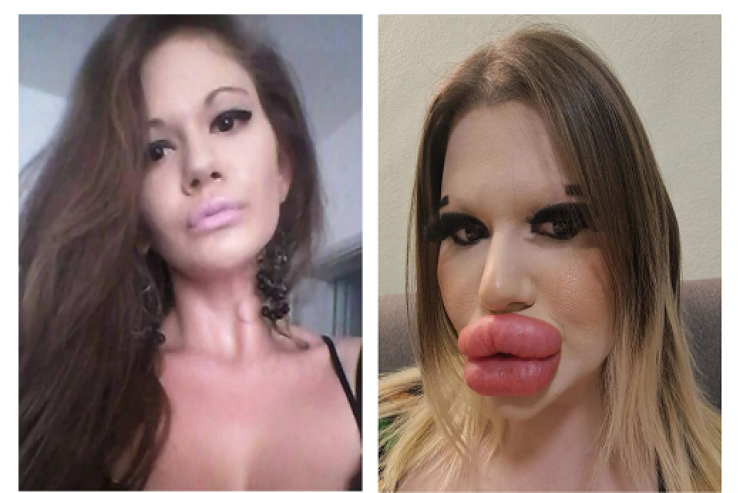 25 min dollar ödəyib özünü  bu günə saldı 