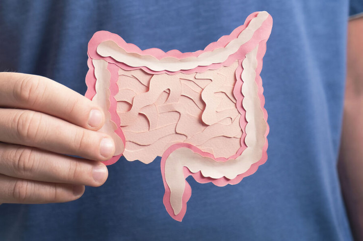 Bağırsaq xərçəngini  yaradan faktor aşkarlandı