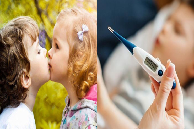 "Öpüş"  virusu uşaqlar arasında belə yayılır - NAZİRLİKDƏN AÇIQLAMA 