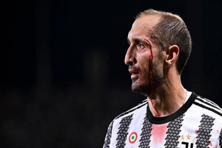 Kellini "Yuventus"a qayıda bilər 