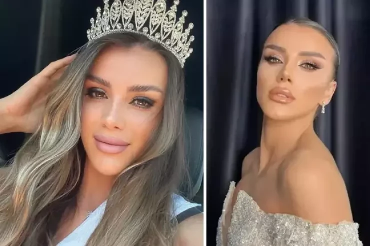 Körpüdən yıxılan avropalı gözəlin ÜSTÜNDƏN MAŞIN KEÇDİ 