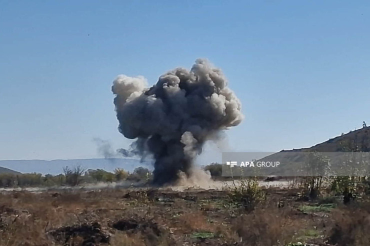 Cəbrayılda minaya düşən ANAMA əməkdaşının ayağı amputasiya olundu 