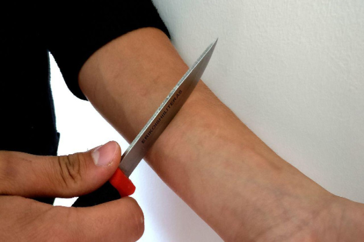 İşdən çıxarıldığı üçün damarlarını kəsdi - Universitetdən AÇIQLAMA  - YENİLƏNİB 