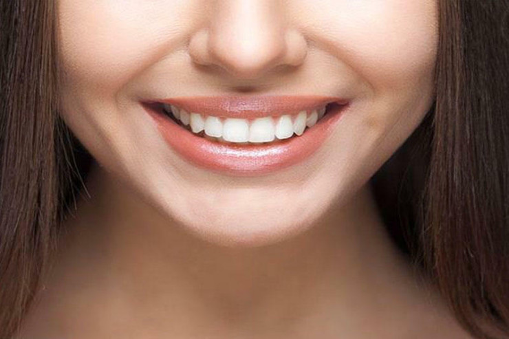  Saxta təbəssümünüz   necə görünür: bilmədiyiniz 3 ƏLAMƏT 