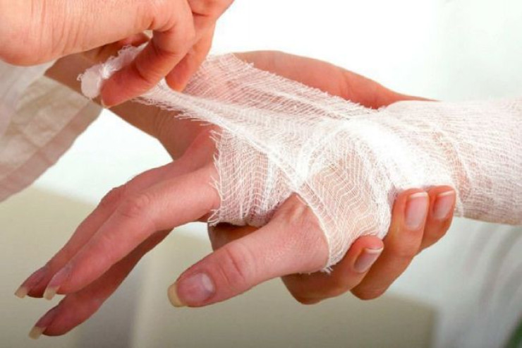 Həkimlər niyə yaraların yodla "yandırılmasını" məsləhət görmürlər? 